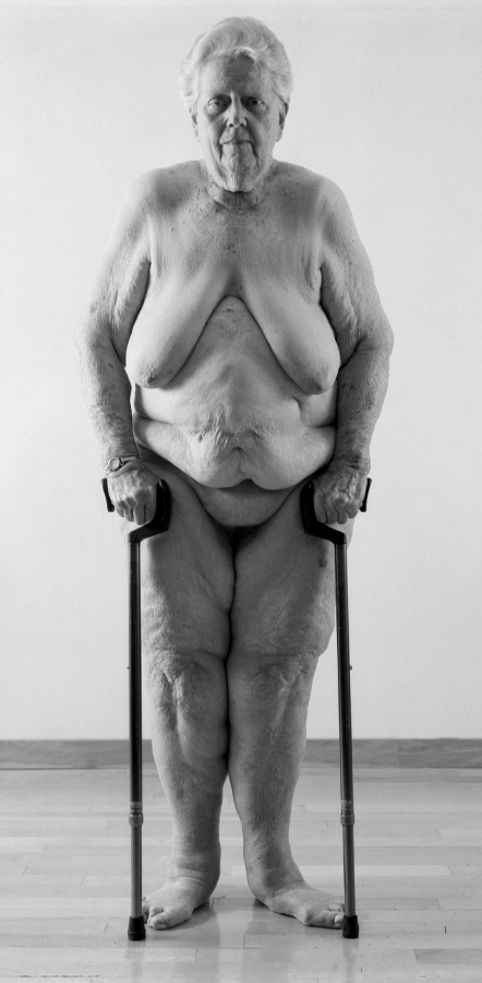 A nude portrait showing an elderly woman standing with two canes, facing the viewer, against a plain background. She wears a silver watch. 